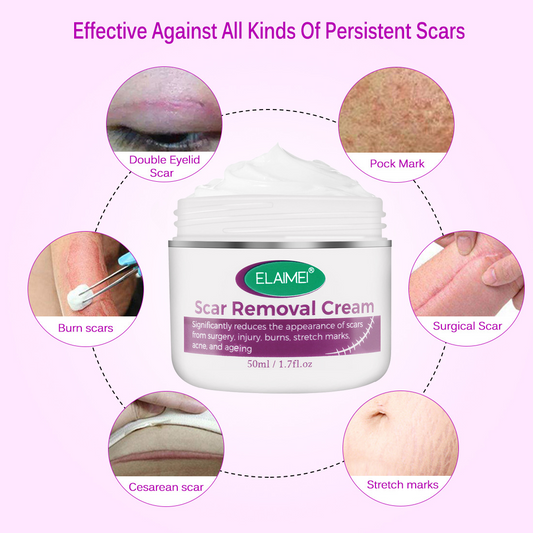 Scar Removal, Stretch Marks Cream