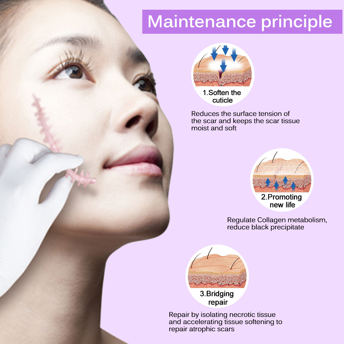 Scar Removal, Stretch Marks Cream